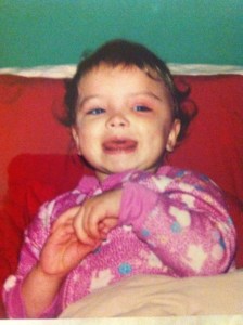 Home after surgery, slighly swollen and bruised, but happy.